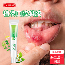 Jufutang Oral Fire gel Mouth bubble Mouth bubble Bad tongue Gum swelling pain repair cream