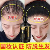 Ginger shampoo anti-hair hair hair growth flagship store add hair anti-dandruff shampoo for men and women
