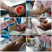 Nurse love public welfare free donation blood donation process shooting HD real shot video footage