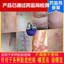 Surgical scar hyperplasia concave and convex scar desalination to acne pit India Heron removal cream skin no time Repair Cream