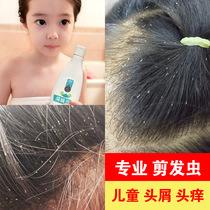 Childrens anti-itching and anti-mite shampoo antibacterial artifact to severe dandruff haircut Shampoo Shampoo for girls