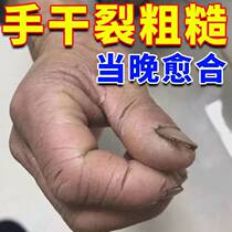 Hand and foot dry repair cream heel dry crack Kening opening frostbite healing cream dry peeling moisturizing anti-cracking cream