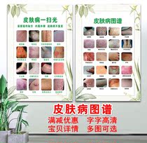 A114 various skin disease Atlas structure posters hanging pictures advertising posters KT foam board PP back glue frameless painting