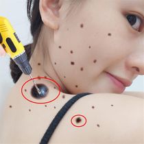 No scab effect is too good to remove all black spots on your face and you are white and good face. Buy 2 for 1