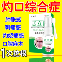 Burning mouth disease burning mouth syndrome tongue crack tongue fever glossitis mouth numbness burning spicy pain pruritus