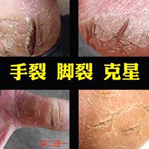 Hand and foot cracking dry cracking artifact dry peeling heel healing repair cream hand and foot anti-cracking cream