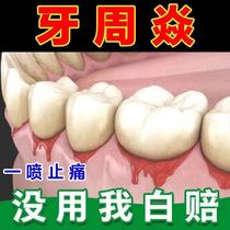 Childrens toothache artifact quick-acting toothache spray inflammation and gum swelling and pain special medicine to cure tooth nerve water
