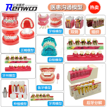 Tooth Model Oral Model Dental Standard Dental Model Dental Model Teaching Denture With Neurodoctor-patient Communication
