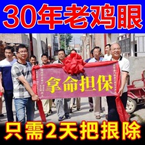 Correction of hand and foot plantar wart corns fish scales removal of artifact corns thorns Baiyun Mountain foot