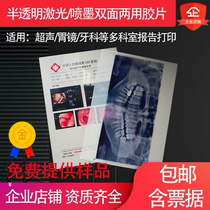 Translucent inkjet laser dual-use medical matte film A4 oral dental film B Super Four-dimensional color ultrasound 150 thick