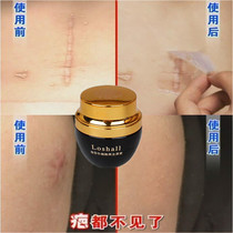 Rosas surgery scar hyperplasia repair ointment bump scar patch light black pigment precipitation acne pit seal