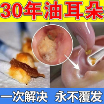 Special medicine for treating otitis media ear canal rot inflammation fungal infection antibacterial ear itching and pus can eradicate itching cream