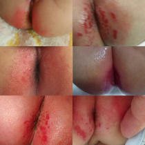 Baby Red Damp Broken Skin Natural Mountain Tea Oil Newborn Pickle Massage Caressing Baby Fart PP Care Butt Oil