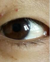 Prevent vision loss complications of myopia activate eye tissue open up the meridians adjust the Tibetan circulation balance Sanqi eye water