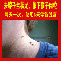  Filamentous warts underarm meat on the neck monkeys goosebumps skin cellulite pimples crow guts etc