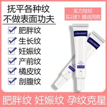 Eliminate stretch marks repair cream pregnant women postpartum elimination of tightening to thigh pregnancy fat pattern students