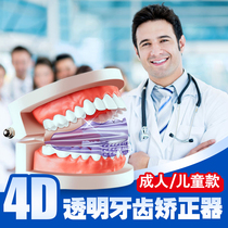 Orthodontic appliances Adult incisors crevice Earth bag day buck teeth Childrens teeth correction Transparent invisible braces Steel