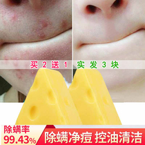 Mite removal artifact cheese milk soap body deep cleaning brushed oil control acne foam clean face wash buy 2 get 1 free