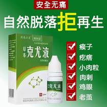 Ke wart liquid filamentous verrucous neck neck head warts removal of Keyou net Keyou liquid monkey meat pimples