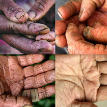 Adult Cracking cream Chapped hand protector Crack healing Cream Chapped repair Chapped hands and feet Heel crack cream