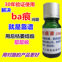 The physical store has been verified for many years. The signature products that are really good for ba marks are professionally used for various surgeries.