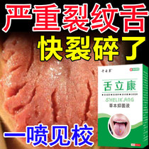 split tongue a spray of geographic tongue groove tongue oral foaming lan zui tongue cracking redness atrophic tongue inflammation