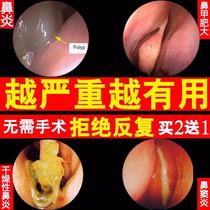 Yashibang rhinitis cream root treatment special effects Miao Family Yashibang earthwork allergic sinusitis Da Miao medicine rhinitis cream
