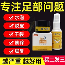 Childrens beriberi ointment soak feet antibacterial removal of erosive foot blisters to root foot odor toe spray fungal treatment