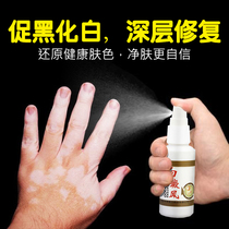 Herb vitiligo inhibitory liquid leukoplakia antibacterial promotion melanin growth vitiligo cover liquid leukoplakia