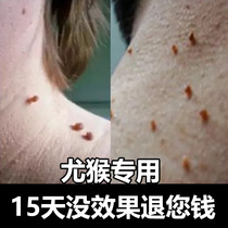 Fluorouracil Ointment Flat Sharp Private 5-fu5% Buddha Pentafluorouracil Ointment Cream 20g