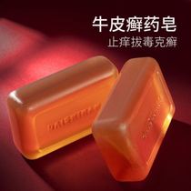 Soap hands and feet wet moss pure psoriasis topical skin Special root cutting eczema Cat Moss dermatitis 1 flat fungal infection