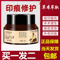 Ru Ni Yuan Scar Cream Repair Essence Cream Caesarean Section Facial Surgery Scald Cream Anti-acne Mark and Scar Cream