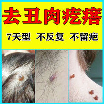 Get rid of monkey neck long small meat pellets Pimple armpit mole removal cream mole medicine point Meat mole Convex mole artifact