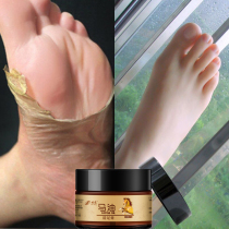 Buy 1 get 1 foot steam buster (cracked hands and feet a touch to restore heel moisturizing moisturizing) Unisex
