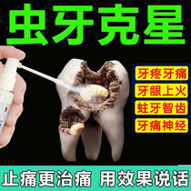Tooth pain medicine for dentistry tooth decay wisdom tooth toothache quick-acting medicine spray treatment of tooth pain