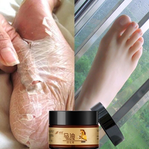 (Buy one get one free)Tender and smooth heels dry hands and feet a touch of recovery for unisex use