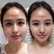 (Recommended by Viya) Small face artifact second change melon seed face Big face buster Buy 3 get 2 Buy 5 get 5