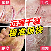 Heel chapped repair cream for cracking chapped dried skin cracked hands and feet