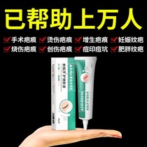 Nanjing Tongrentang Shabu ointment scar net care scar ointment hyperplasia acne seal official flagship store official website