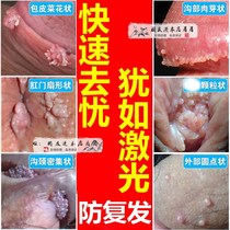 Warts will clear warts will cure the spirit to remove the private parts of men and women especially the sharp meat particles to find the seeds to clean up the warts