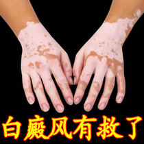 White purpura white spot covered liquid to white white purpura net Flawless Liniment wind Non-external melanin Hand Facial Flawless Cream Cream