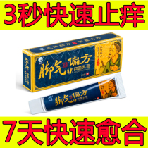 Treatment of itchy feet Antibacterial foot eczema Foot eczema foot eczema anti-itch Deer Shen Li Shen Beriberi homeostatic antibacterial cream
