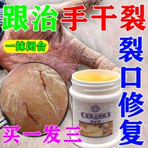 Dry hands and feet peeling skin repair chapped crack crack anti-cracking hand cream dry hands and feet dry rough finger protection cracked opening