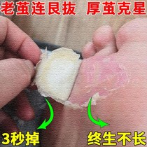 Remove dead skin calluses from the feet remove calluses from the hands crusty skin thick cocoon softener toes joints soles of the feet