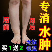 To lower extremity edema swelling old man at the foot of the calf face face systemic edema row edema artifact stickers foot