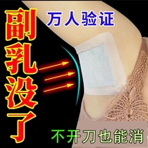 The auxiliary milk is gone (buy two get 1) dredge the lymph and eliminate the accessory milk artifact.