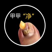 Weiya hot sale recommended to enjoy a good potassium drop a drop of bad potassium net potassium good potassium are clean