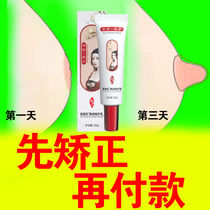 (first rectified repayment) nipple endosubsidence aligner suction special effects paste correction of milk head short and small hair loss