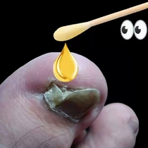 The effect is so good not to be plucked out of the morning and sooner or later. 3 hair 5 Bad A gram 3.