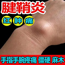 (a box is good) Achilles tendon Tendon Cream Balm drum Pack finger wrist joint pain Flexor Pain Special Plasters
